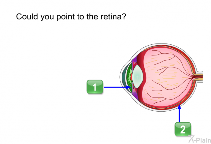 Could you point to the retina?