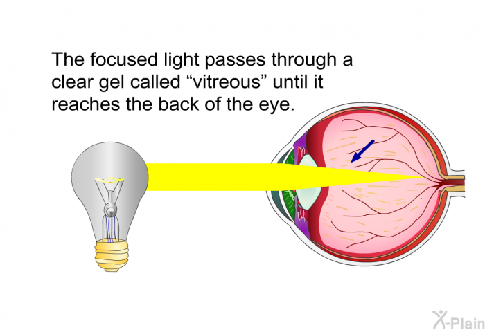 The focused light passes through a clear gel called <I>vitreous</I> until it reaches the back of the eye.