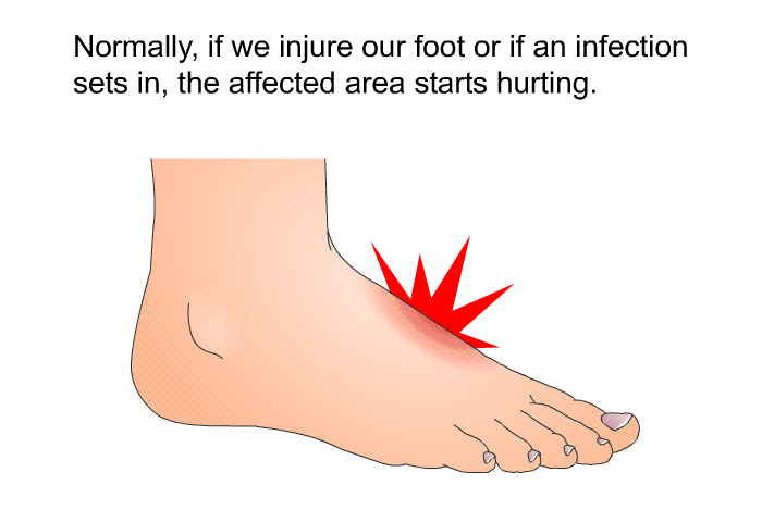Normally, if we injure our foot or if an infection sets in, the affected area starts hurting.