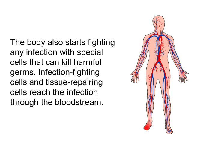 The body also starts fighting any infection with special cells that can kill harmful germs. Infection-fighting cells and tissue-repairing cells reach the infection through the bloodstream.
