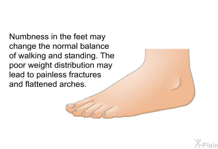 Numbness in the feet may change the normal balance of walking and standing. The poor weight distribution may lead to painless fractures and flattened arches.