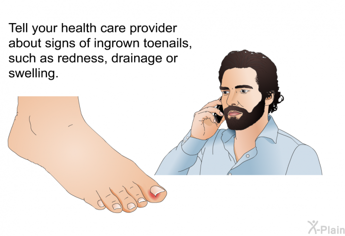 Tell your health care provider about signs of ingrown toenails, such as redness, drainage or swelling.