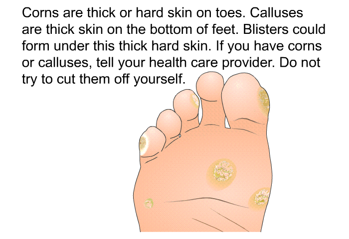 Corns are thick or hard skin on toes. Calluses are thick skin on the bottom of feet. Blisters could form under this thick hard skin. If you have corns or calluses, tell your health care provider. Do not try to cut them off yourself.