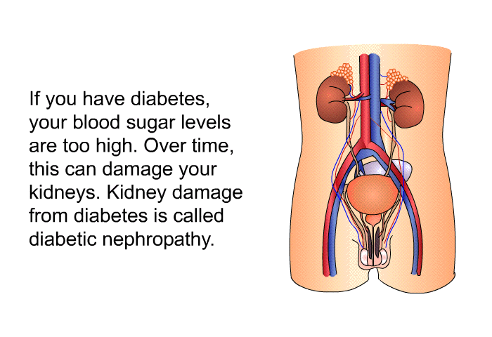 If you have diabetes, your blood sugar levels are too high. Over time, this can damage your kidneys. Kidney damage from diabetes is called diabetic nephropathy.