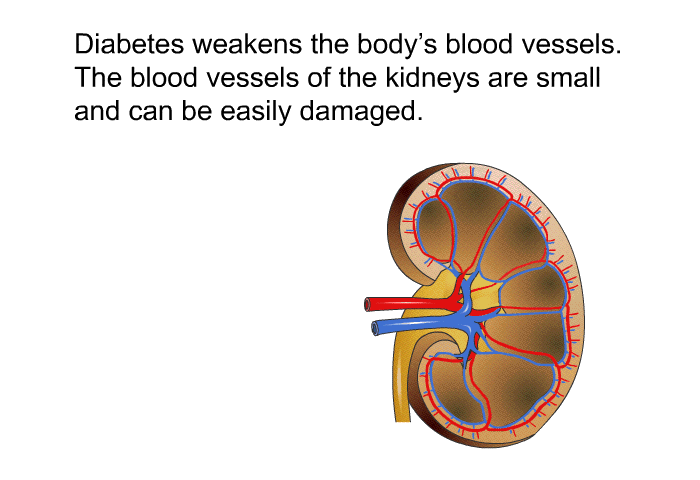 Diabetes weakens the body's blood vessels. The blood vessels of the kidneys are small and can be easily damaged.
