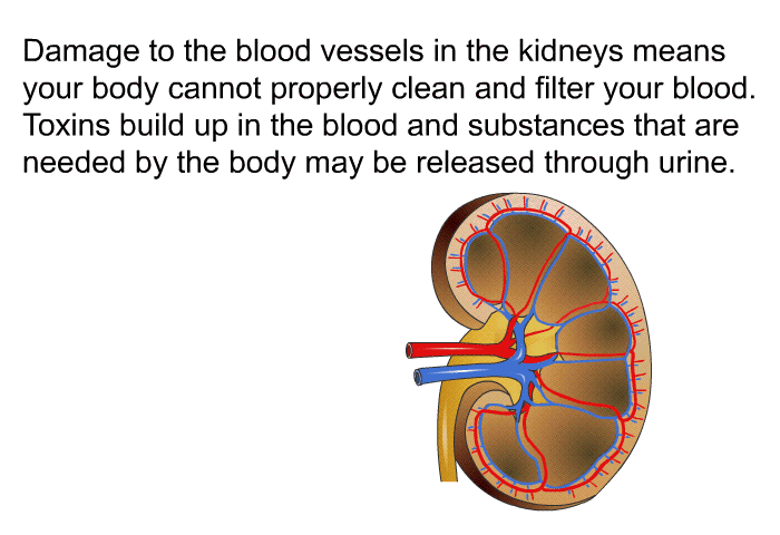 Damage to the blood vessels in the kidneys means your body cannot properly clean and filter your blood. Toxins build up in the blood and substances that are needed by the body may be released through urine.