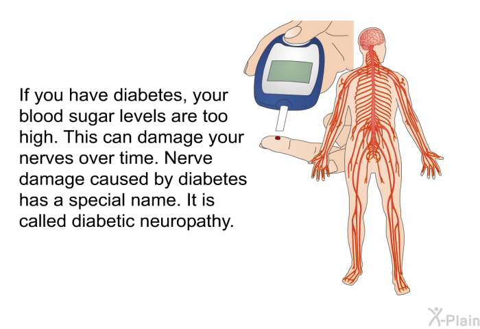 If you have diabetes, your blood sugar levels are too high. This can damage your nerves over time. Nerve damage caused by diabetes has a special name. It is called diabetic neuropathy.