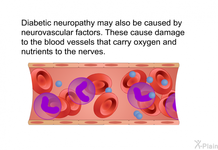 Diabetic neuropathy may also be caused by neurovascular factors. These cause damage to the blood vessels that carry oxygen and nutrients to the nerves.