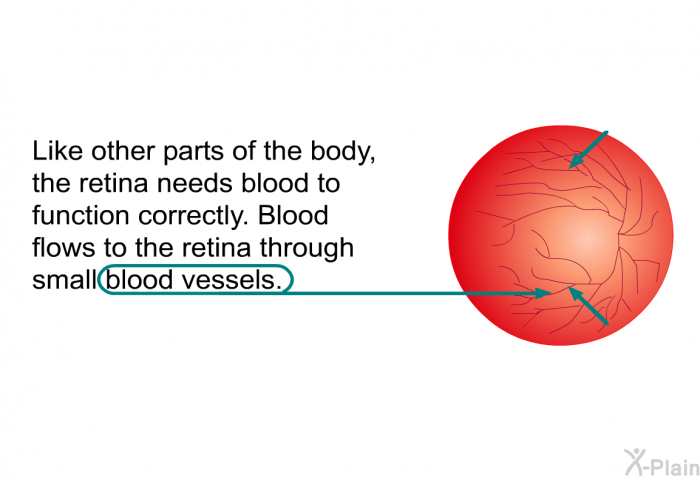 Like other parts of the body, the retina needs blood to function correctly. Blood flows to the retina through small blood vessels.