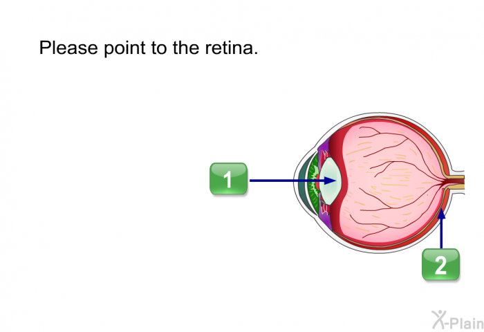 Please point to the retina. (A Vitreous; B Retina)