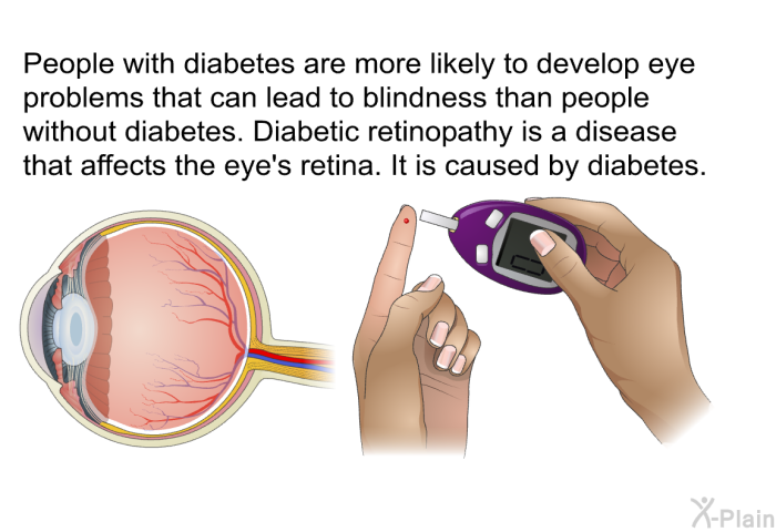 People with diabetes are more likely to develop eye problems that can lead to blindness than people without diabetes. Diabetic retinopathy is a disease that affects the eye's retina. It is caused by diabetes.