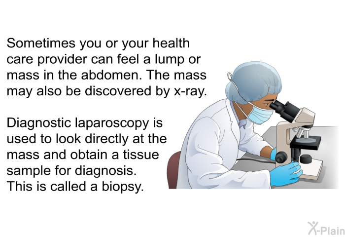 Sometimes you or your health care provider can feel a lump or mass in the abdomen. The mass may also be discovered by x-ray. Diagnostic laparoscopy is used to look directly at the mass and obtain a tissue sample for diagnosis. This is called a biopsy.