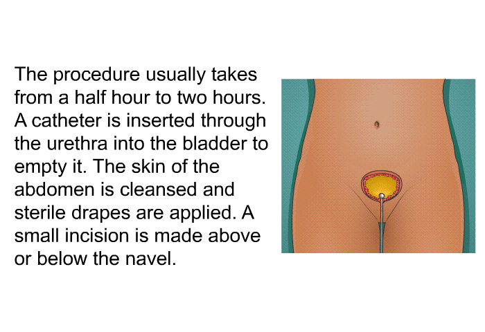 The procedure usually takes from a half hour to two hours. A catheter is inserted through the urethra into the bladder to empty it. The skin of the abdomen is cleansed and sterile drapes are applied. A small incision is made above or below the navel.