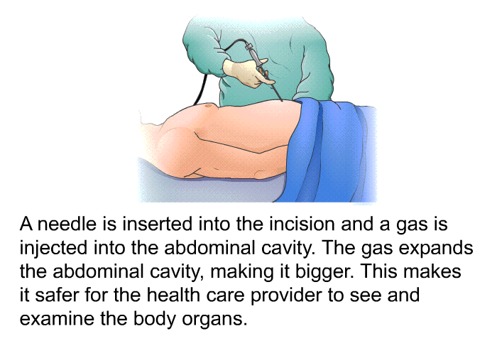 A needle is inserted into the incision and a gas is injected into the abdominal cavity. The gas expands the abdominal cavity, making it bigger. This makes it safer for the health care provider to see and examine the body organs.