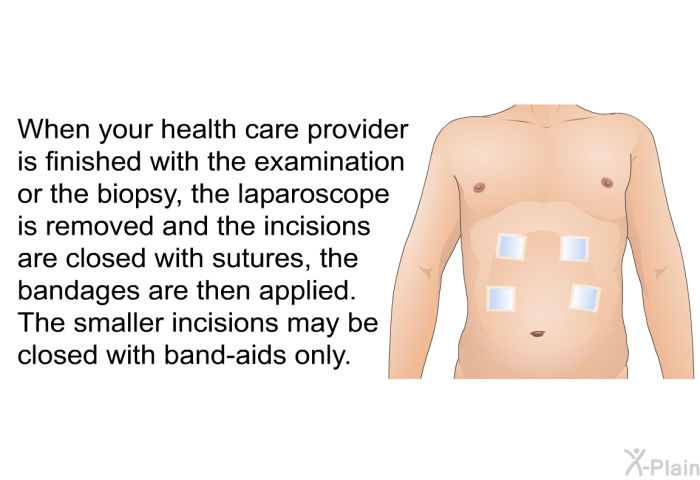 When your health care provider is finished with the examination or the biopsy, the laparoscope is removed and the incisions are closed with sutures, the bandages are then applied. The smaller incisions may be closed with band-aids only.