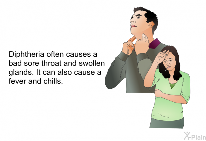 Diphtheria often causes a bad sore throat and swollen glands. It can also cause a fever and chills.