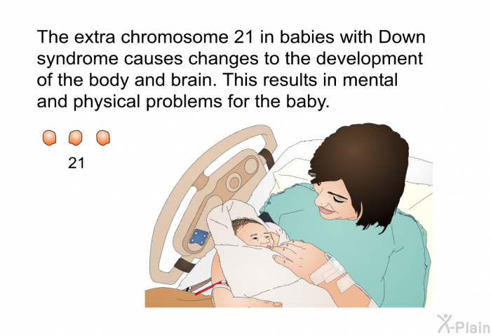 The extra chromosome 21 in babies with Down syndrome causes changes to the development of the body and brain. This results in mental and physical problems for the baby.