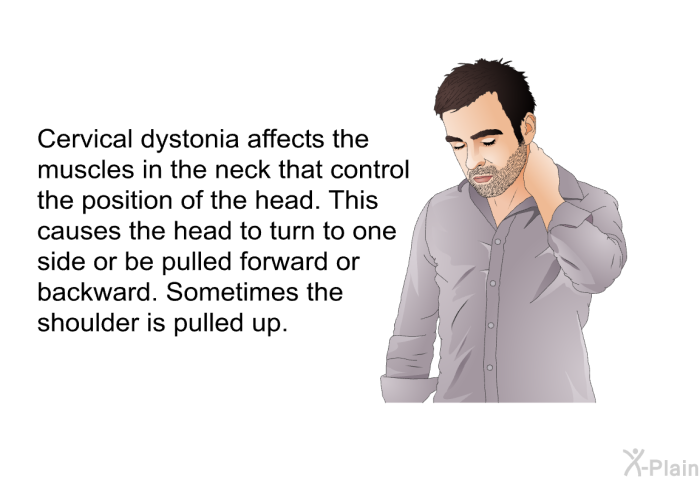 Cervical dystonia affects the muscles in the neck that control the position of the head. This causes the head to turn to one side or be pulled forward or backward. Sometimes the shoulder is pulled up.