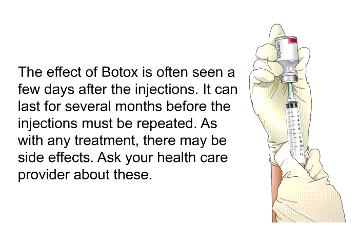 The effect of Botox is often seen a few days after the injections. It can last for several months before the injections must be repeated. As with any treatment, there may be side effects. Ask your health care provider about these.