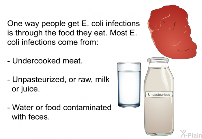 One way people get E. coli infections is through the food they eat. Most E. coli infections come from:  Undercooked meat. Unpasteurized, or raw, milk or juice. Water or food contaminated with feces.