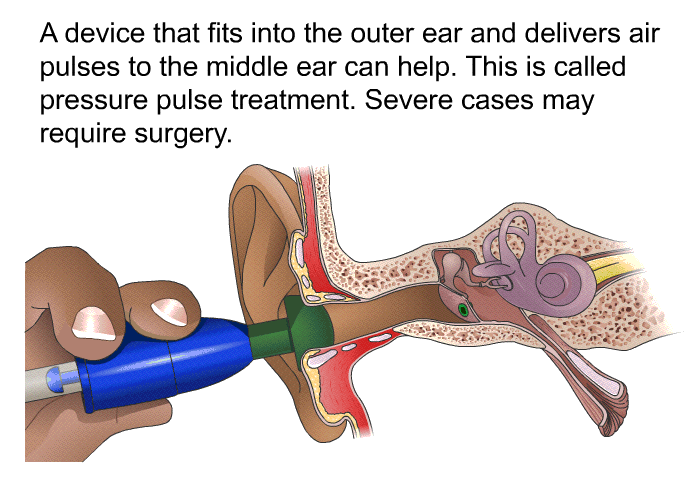 A device that fits into the outer ear and delivers air pulses to the middle ear can help. This is called pressure pulse treatment. Severe cases may require surgery.