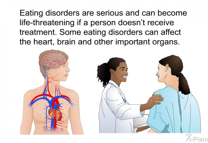 Eating disorders are serious and can become life-threatening if a person doesn't receive treatment. Some eating disorders can affect the heart, brain and other important organs.