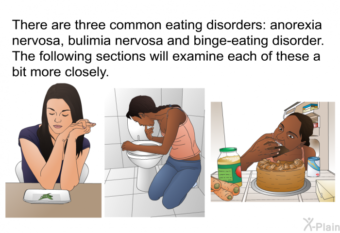 There are three common eating disorders: anorexia nervosa, bulimia nervosa and binge-eating disorder. The following sections will examine each of these a bit more closely.