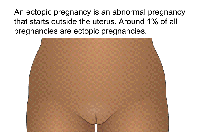 An ectopic pregnancy is an abnormal pregnancy that starts outside the uterus. Around 1% of all pregnancies are ectopic pregnancies.