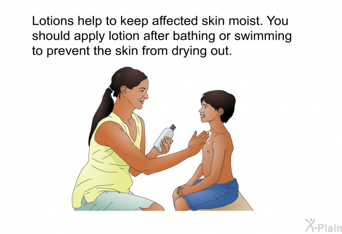 Lotions help to keep affected skin moist. You should apply lotion after bathing or swimming to prevent the skin from drying out.