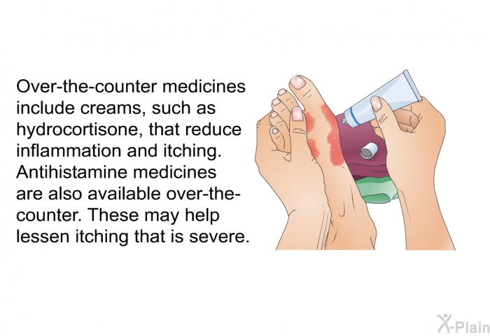 Over-the-counter medicines include creams, such as hydrocortisone, that reduce inflammation and itching. Antihistamine medicines are also available over-the-counter. These may help lessen itching that is severe.