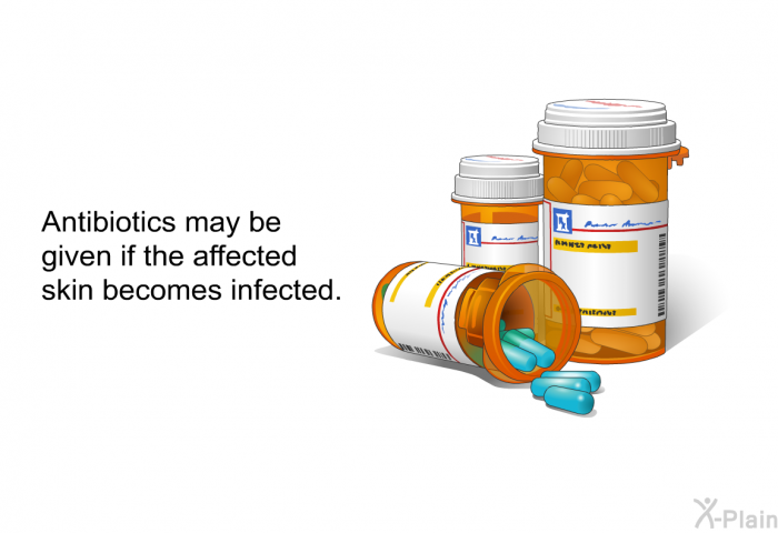 Antibiotics may be given if the affected skin becomes infected.