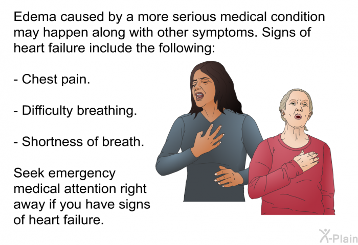 Edema caused by a more serious medical condition may happen along with other symptoms. Signs of heart failure include the following:  Chest pain. Difficulty breathing. Shortness of breath.  
 Seek emergency medical attention right away if you have signs of heart failure.