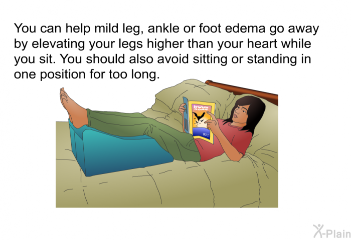You can help mild leg, ankle or foot edema go away by elevating your legs higher than your heart while you sit. You should also avoid sitting or standing in one position for too long.