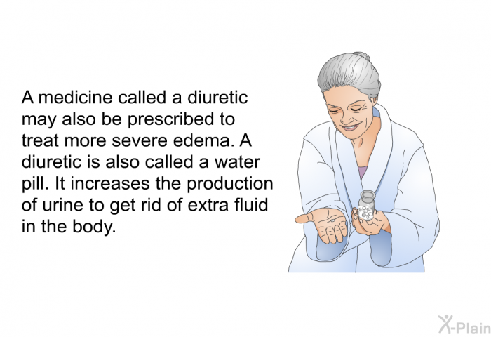 A medicine called a diuretic may also be prescribed to treat more severe edema. A diuretic is also called a water pill. It increases the production of urine to get rid of extra fluid in the body.