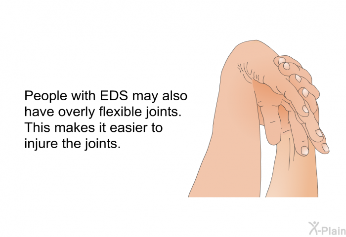 People with EDS may also have overly flexible joints. This makes it easier to injure the joints.