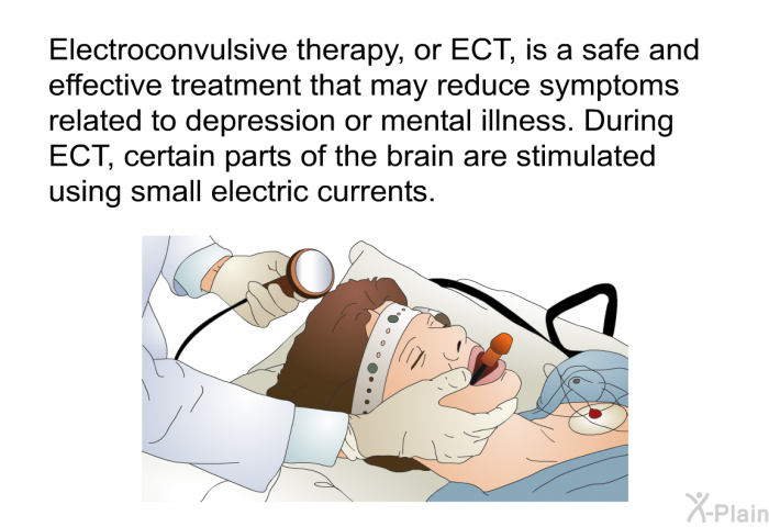 Electroconvulsive therapy, or ECT, is a safe and effective treatment that may reduce symptoms related to depression or mental illness. During ECT, certain parts of the brain are stimulated using small electric currents.
