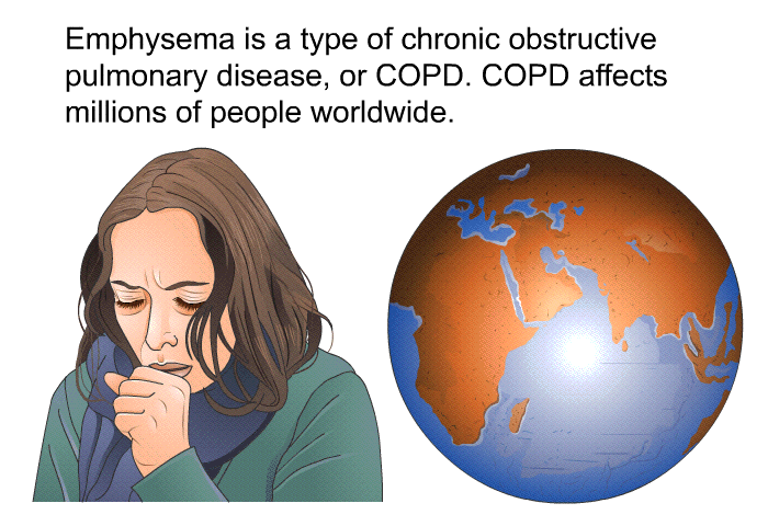 Emphysema is a type of chronic obstructive pulmonary disease, or COPD. COPD affects millions of people worldwide.