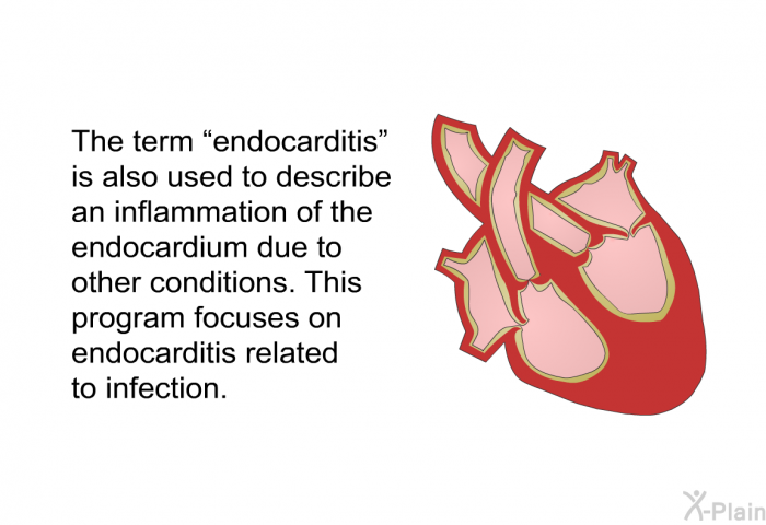 The term “endocarditis” is also used to describe an inflammation of the endocardium due to other conditions. This program focuses on endocarditis related to infection.