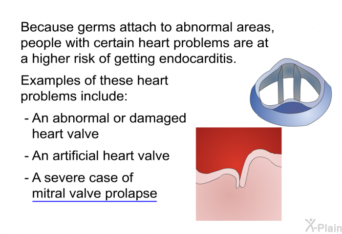 Because germs attach to abnormal areas, people with certain heart problems are at a higher risk of getting endocarditis. Examples of these heart problems include:  An abnormal or damaged heart valve An artificial heart valve A severe case of mitral valve prolapse