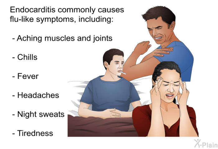 Endocarditis commonly causes flu-like symptoms, including:  Aching muscles and joints Chills Fever Headaches Night sweats Tiredness