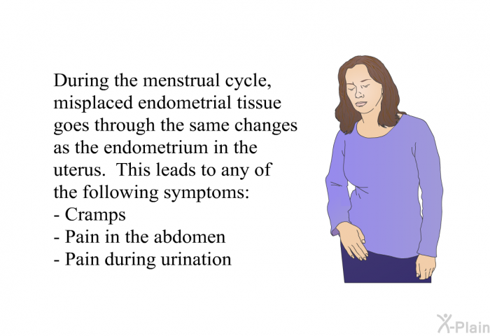 During the menstrual cycle, misplaced endometrial tissue goes through the same changes as the endometrium in the uterus. This leads to any of the following symptoms:  Cramps Pain in the abdomen Pain during urination
