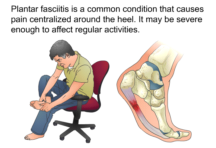 Plantar fasciitis is a common condition that causes pain centralized around the heel. It may be severe enough to affect regular activities.