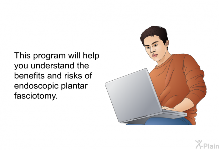 This health information will help you understand the benefits and risks of endoscopic plantar fasciotomy.