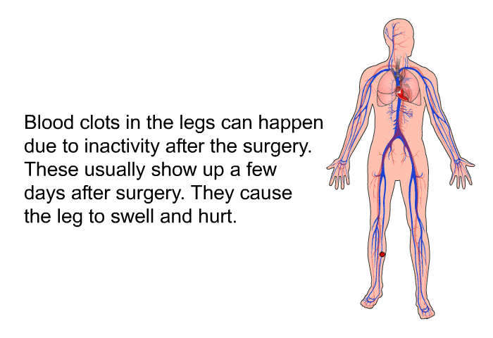 Blood clots in the legs can happen due to inactivity after the surgery. These usually show up a few days after surgery. They cause the leg to swell and hurt.