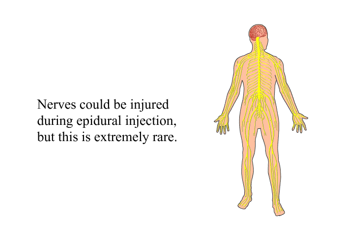 Nerves could be injured during epidural injection, but this is extremely rare.