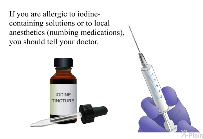 If you are allergic to iodine-containing solutions or to local anesthetics (numbing medications), you should tell your doctor.