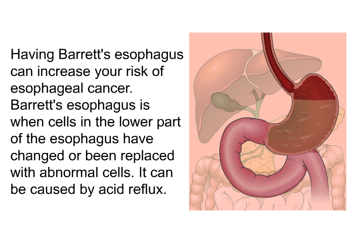 Having Barrett's esophagus can increase your risk of esophageal cancer. Barrett's esophagus is when cells in the lower part of the esophagus have changed or been replaced with abnormal cells. It can be caused by acid reflux.
