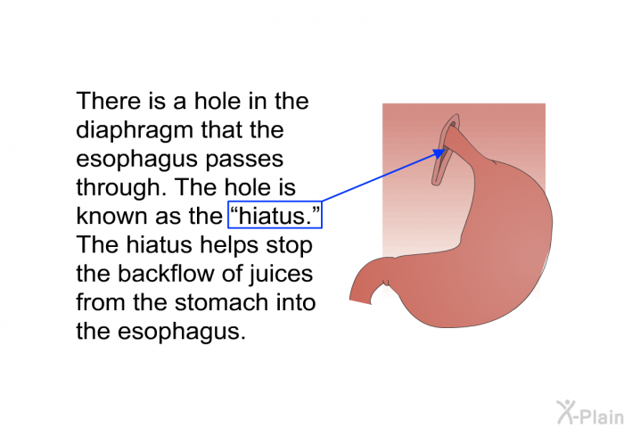 There is a hole in the diaphragm that the esophagus passes through. The hole is known as the “hiatus.” The hiatus helps stop the backflow of juices from the stomach into the esophagus.