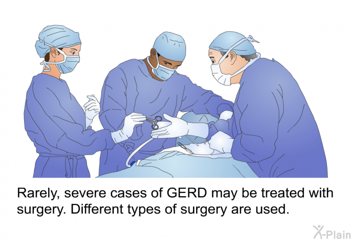 Rarely, severe cases of GERD may be treated with surgery. Different types of surgery are used.