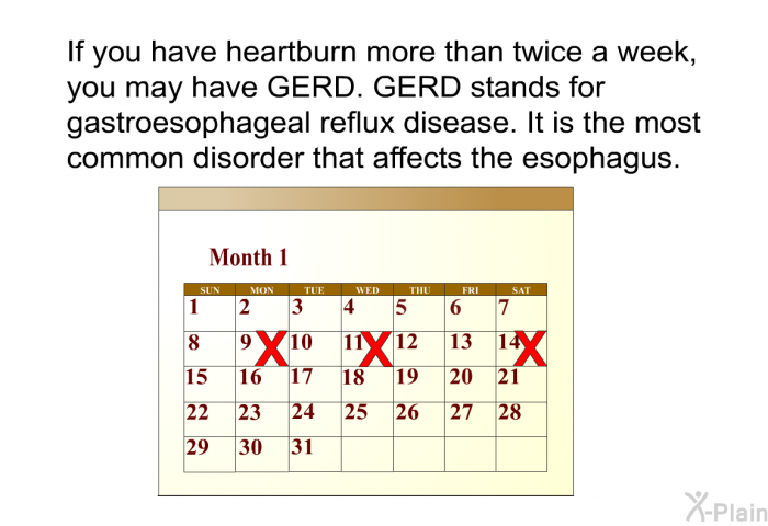If you have heartburn more than twice a week, you may have GERD. GERD stands for gastroesophageal reflux disease. It is the most common disorder that affects the esophagus.